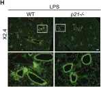 Fig.3.H showing Immunohistochemistry-immunofluorescence in a Mus musculus (House mouse) sample from the publication: p21 facilitates chronic lung inflammation via epithelial and endothelial cells.