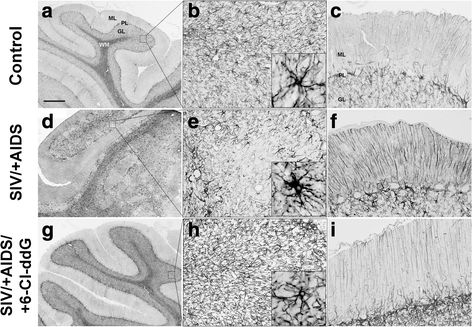 Loss of cerebellar neurons in the progression of lentiviral disease: effects of CNS-permeant antiretroviral therapy.