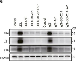Fig.7.G showing Western Blotting from the publication: Andrographolide attenuates microglial senescence in Alzheimer's disease mice by suppressing the STAT3 signaling.