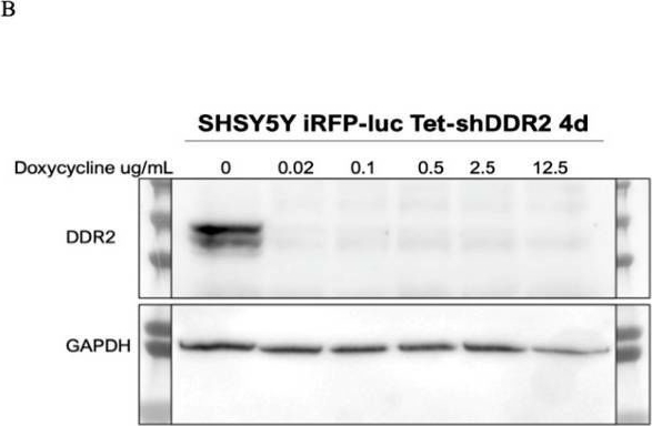 Fig.1.B showing Western Blotting in a Homo sapiens (Human) sample from the publication: Investigation of Cell Mechanics and Migration on DDR2-Expressing Neuroblastoma Cell Line.