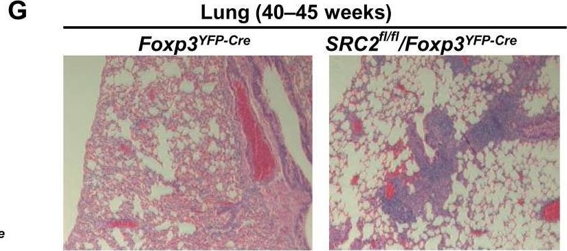 Fig.3.G showing Immunohistochemistry in a Mus musculus (House mouse) sample from the publication: Steroid nuclear receptor coactivator 2 controls immune tolerance by promoting induced Treg differentiation via up-regulating Nr4a2.