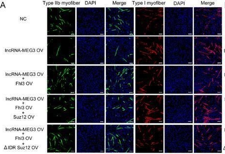 Fig.8.A showing Immunocytochemistry-immunofluorescence in a Mus musculus (House mouse) sample from the publication: LncRNA-MEG3 Regulates Muscle Mass and Metabolic Homeostasis by Facilitating SUZ12 Liquid-Liquid Phase Separation.
