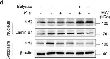 Fig.4.D showing Western Blotting from the publication: Butyrate protects against Klebsiella pneumoniae-induced oxidative stress in alveolar macrophages via p62-Keap1-Nrf2 pathway.