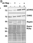 Fig.5.B showing Western Blotting in a Homo sapiens (Human) sample from the publication: Reptin regulates DNA double strand breaks repair in human hepatocellular carcinoma.