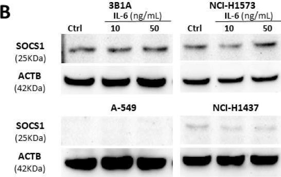 Fig.3.B showing Western Blotting in a Homo sapiens (Human) sample from the publication: SOCS1 Inhibits IL-6-Induced CD155 Overexpression in Lung Adenocarcinoma.