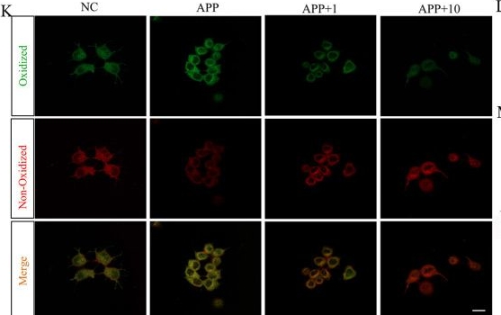 Fig.6.K showing Immunocytochemistry-immunofluorescence in a Mus musculus (House mouse) sample from the publication: Cynanchum bungei Decne-derived extracellular vesicles alleviate cognitive impairment and pathological damage in Alzheimer's disease.