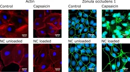 Fig.5.A showing Immunocytochemistry-immunofluorescence in a Canis lupus familiaris (Domestic dog) sample from the publication: Nanoencapsulated capsaicin changes migration behavior and morphology of madin darby canine kidney cell monolayers.