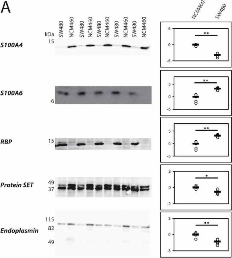 Fig.4.A showing Western Blotting in a Homo sapiens (Human) sample from the publication: Proteomic Characterization of Colorectal Cancer Cells versus Normal-Derived Colon Mucosa Cells: Approaching Identification of Novel Diagnostic Protein Biomarkers in Colorectal Cancer.