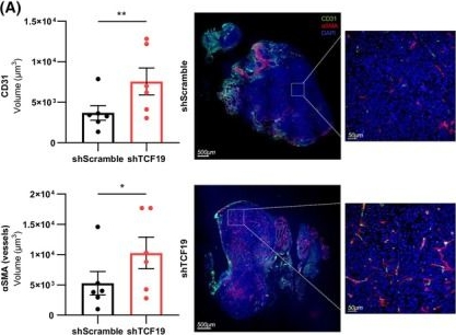 Fig.7.A showing Immunocytochemistry-immunofluorescence from the publication: A bioinformatics screen identifies TCF19 as an aggressiveness-sustaining gene in prostate cancer.