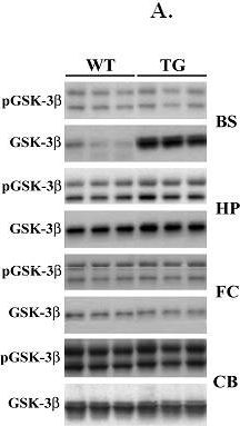 Fig.4.A showing Western Blotting in a Mus musculus (House mouse) sample from the publication: Region-specific tauopathy and synucleinopathy in brain of the alpha-synuclein overexpressing mouse model of Parkinson's disease.