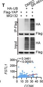 Fig.2.T showing Western Blotting from the publication: Cyclin K condensates bridge CDK12 to phosphorylate and drive oncogenic YAP activation in hepatocellular carcinoma.