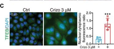 Fig.5.C showing Immunocytochemistry-immunofluorescence in a Homo sapiens (Human) sample from the publication: Disturbing Cholesterol/Sphingolipid Metabolism by Squalene Epoxidase Arises Crizotinib Hepatotoxicity.