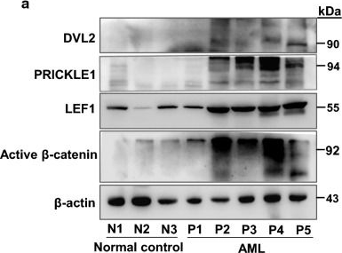 Fig.7.A showing Western Blotting in a Homo sapiens (Human) sample from the publication: PRICKLE1, a Wnt/PCP signaling component, is overexpressed and associated with inferior prognosis in acute myeloid leukemia.