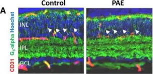 Fig.4.A showing Immunohistochemistry in a Mus musculus (House mouse) sample from the publication: In Utero Alcohol Exposure Impairs Retinal Angiogenesis and the Microvessel-Associated Positioning of Calretinin Interneurons.