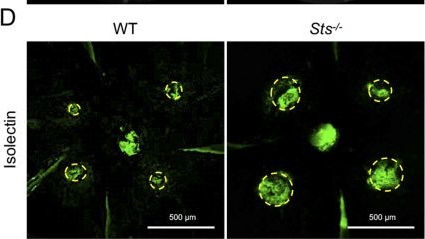 Fig.7.D showing Immunocytochemistry-immunofluorescence from the publication: Macrophage Sult2b1 promotes pathological neovascularization in age-related macular degeneration.