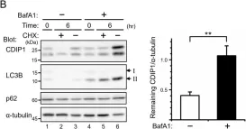 Fig.3.B showing Western Blotting in a Homo sapiens (Human) sample from the publication: Cytoprotective Role of Autophagy in CDIP1 Expression-Induced Apoptosis in MCF-7 Breast Cancer Cells.