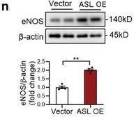 Fig.6.N showing Western Blotting from the publication: Cardiac Urea Cycle Activation by Time-Restricted Feeding Protects Against Pressure Overload-Induced Heart Failure.