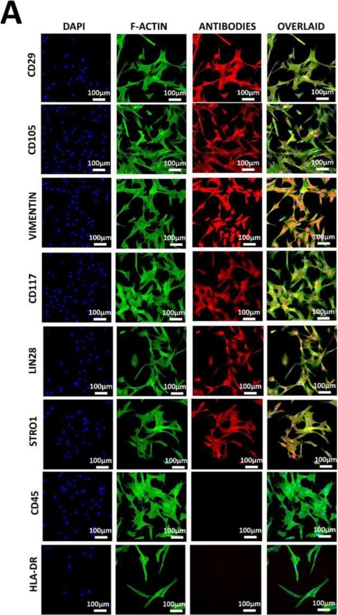 Fig.2.A showing Immunocytochemistry-immunofluorescence in a Homo sapiens (Human) sample from the publication: Overexpression of OLIG2 and MYT1L Transcription Factors Enhance the Differentiation Potential of Human Mesenchymal Stem Cells into Oligodendrocytes.