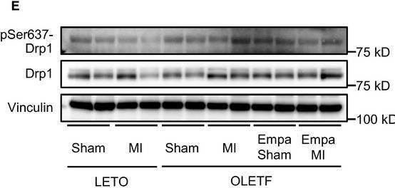 Fig.5.E showing Western Blotting from the publication: Empagliflozin normalizes the size and number of mitochondria and prevents reduction in mitochondrial size after myocardial infarction in diabetic hearts.