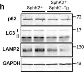 Fig.5.H showing Western Blotting from the publication: Sphingosine kinase-2 prevents macrophage cholesterol accumulation and atherosclerosis by stimulating autophagic lipid degradation.