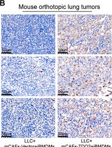 Fig.6.B showing Immunohistochemistry in a Mus musculus (House mouse) sample from the publication: IL4I1⁺ Macrophages and TDO2⁺ Myofibroblasts Drive AhR-Mediated Immunosuppression and Ferroptosis Resistance in Solid Predominant Lung Adenocarcinoma.