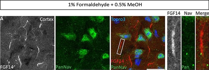 Fig.8.A showing Immunohistochemistry-immunofluorescence in a Mus musculus (House mouse) sample from the publication: Improved Methods for Fluorescence Microscopy Detection of Macromolecules at the Axon Initial Segment.