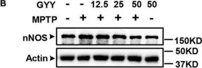 Fig.4.B showing Western Blotting in a Mus musculus (House mouse) sample from the publication: GYY4137, an H2S Slow-Releasing Donor, Prevents Nitrative Stress and α-Synuclein Nitration in an MPTP Mouse Model of Parkinson's Disease.