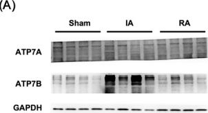 Fig.2.A showing Western Blotting from the publication: Elevated COMMD1 Contributes to Cardiomyocyte Copper Efflux in Chronic Myocardial Ischemia: Insights From Rhesus Monkey.