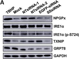 Fig.4.A showing Western Blotting in a Homo sapiens (Human) sample from the publication: Non-Targeting shRNA-Encoded Plasmid DNA Enhances Protective Immunity Through RIDD-RIG-I Signaling Pathway in the Zika Virus Animal Model.