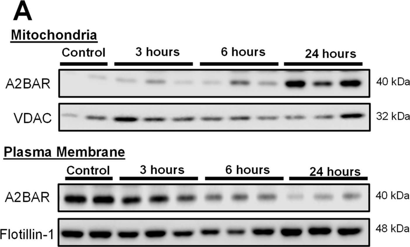 Fig.2.A showing Western Blotting in a Mus musculus (House mouse) sample from the publication: Translocation of Adenosine A2B Receptor to Mitochondria Influences Cytochrome P450 2E1 Activity after Acetaminophen Overdose.