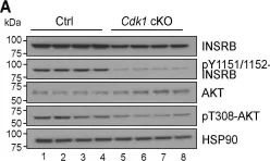 Fig.5.A showing Western Blotting from the publication: Remodeling of whole-body lipid metabolism and a diabetic-like phenotype caused by loss of CDK1 and hepatocyte division.