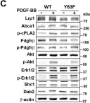 Fig.4.C showing Western Blotting in a Mus musculus (House mouse) sample from the publication: LRP1 integrates murine macrophage cholesterol homeostasis and inflammatory responses in atherosclerosis.