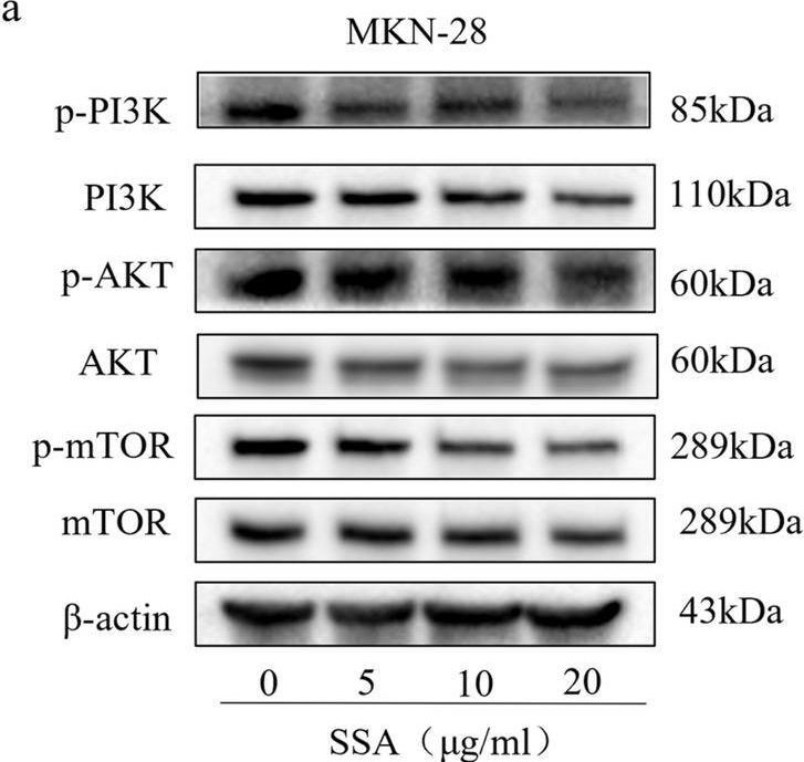 Fig.7.A showing Western Blotting in a Homo sapiens (Human) sample from the publication: The potential effect and mechanism of Saikosaponin A against gastric cancer.