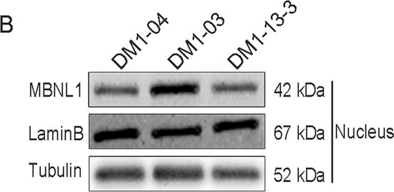 Fig.2.B showing Western Blotting from the publication: MBNL1 reverses the proliferation defect of skeletal muscle satellite cells in myotonic dystrophy type 1 by inhibiting autophagy via the mTOR pathway.