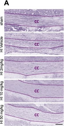 Fig.4.A showing Immunohistochemistry in a Rattus norvegicus (Rat) sample from the publication: Sildenafil reduced neuroinflammation and improved white matter injury in a rat model of term neonatal hypoxic-ischemic encephalopathy.