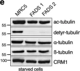 Fig.4.E showing Western Blotting from the publication: Centrosome and ciliary abnormalities in fetal akinesia deformation sequence human fibroblasts.