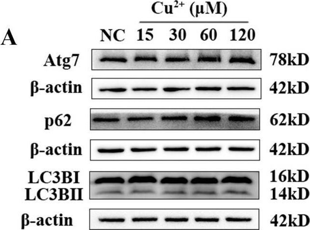 Fig.3.A showing Western Blotting in a Homo sapiens (Human) sample from the publication: The Role of Autophagy in Copper-Induced Apoptosis and Developmental Neurotoxicity in SH-SY5Y Cells.