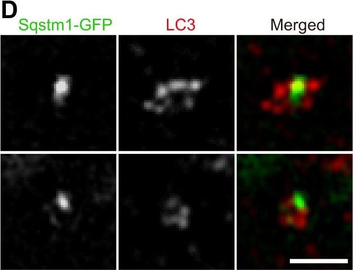 Sqstm1-GFP knock-in mice reveal dynamic actions of Sqstm1 during autophagy and under stress conditions in living cells.