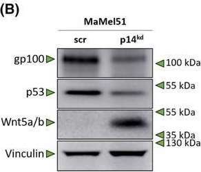Fig.7.B showing Western Blotting in a Homo sapiens (Human) sample from the publication: Loss of p14 diminishes immunogenicity in melanoma via non-canonical Wnt signaling by reducing the peptide surface density.