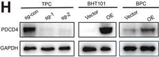Fig.5.H showing Western Blotting in a Homo sapiens (Human) sample from the publication: Spatial Transcriptomics Reveals Transcriptomic and Immune Microenvironment Reprogramming during Thyroid Carcinoma Dedifferentiation.