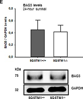 Sequestosome 1 Deficiency Delays, but Does Not Prevent Brain Damage Formation Following Acute Brain Injury in Adult Mice.