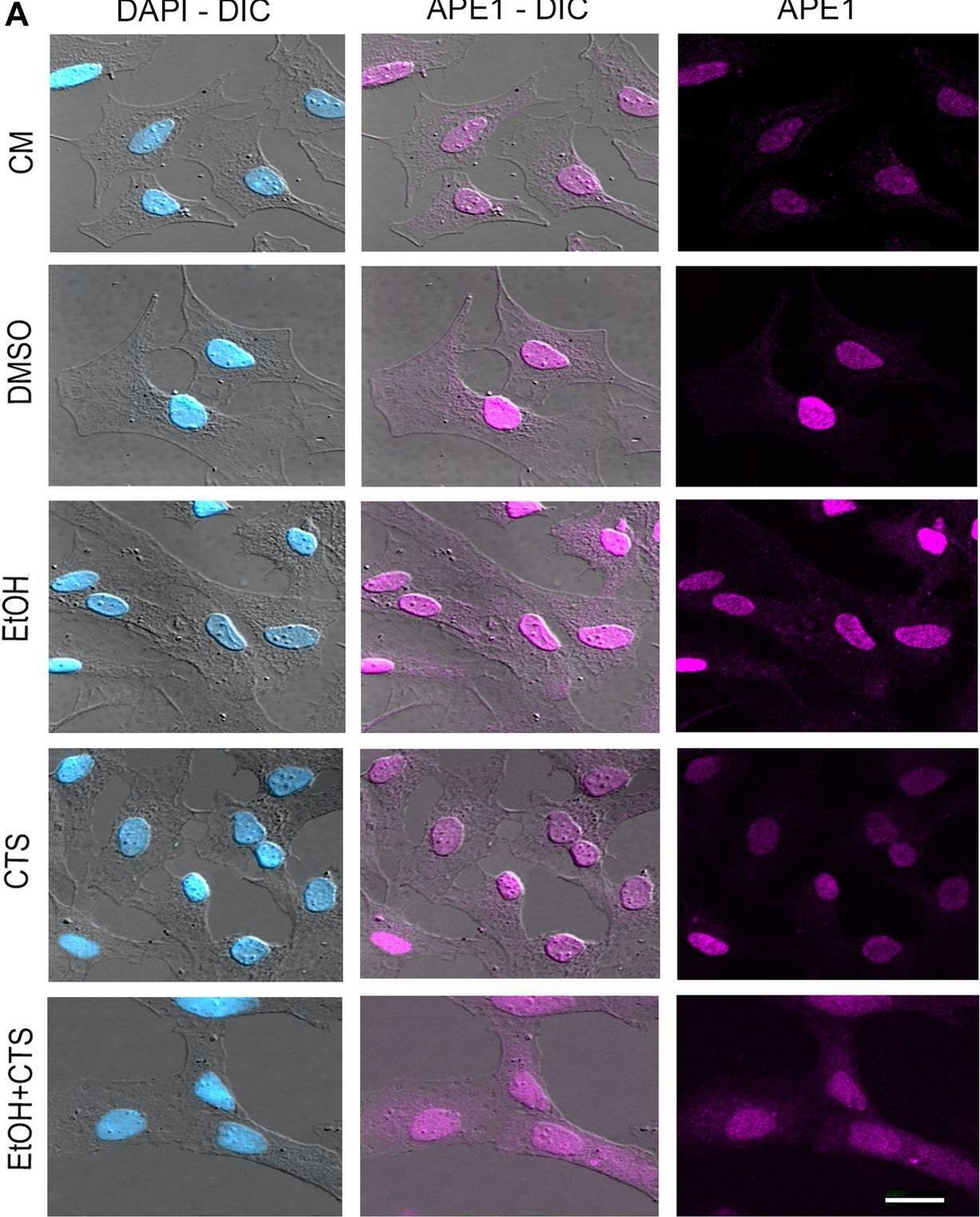 Fig.6.A showing Immunocytochemistry-immunofluorescence in a Rattus norvegicus (Rat) sample from the publication: Astrocyte DNA damage and response upon acute exposure to ethanol and corticosterone.