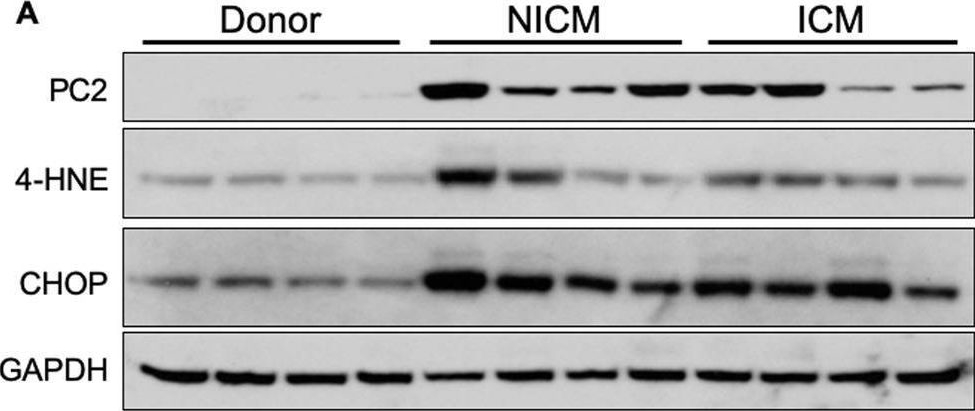 Fig.3.A showing Western Blotting in a Homo sapiens (Human) sample from the publication: Polycystin 2 is increased in disease to protect against stress-induced cell death.