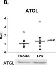 Fig.4.B showing Western Blotting in a Homo sapiens (Human) sample from the publication: Regulation of Lipolysis and Adipose Tissue Signaling during Acute Endotoxin-Induced Inflammation: A Human Randomized Crossover Trial.