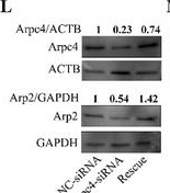 Fig.5.L showing Western Blotting from the publication: Microfilament-Myosin II Regulates the Differentiation of Multinucleated Cysts into Oocytes and Influences Oocyte Developmental Potential in Mice.