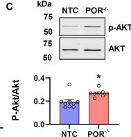 Fig.5.C showing Western Blotting from the publication: Endothelial cytochrome P450 -derived cholesterol limits angiogenesis.
