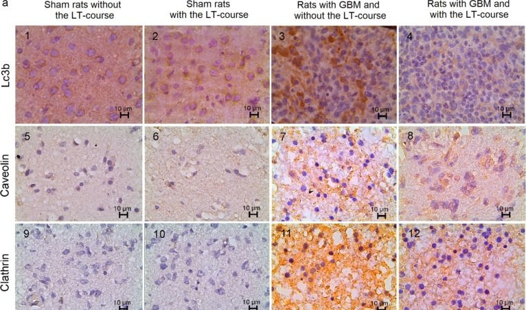 Fig.4.A showing Immunohistochemistry in a Rattus norvegicus (Rat) sample from the publication: Transcranial Photosensitizer-Free Laser Treatment of Glioblastoma in Rat Brain.