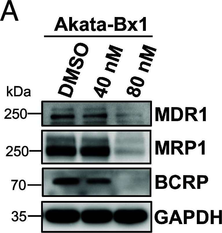 Fig.4.A showing Western Blotting from the publication: NEK2 drives pathogenesis, drug resistance, and LMP1 expression in EBV-positive non-Hodgkin lymphoma.