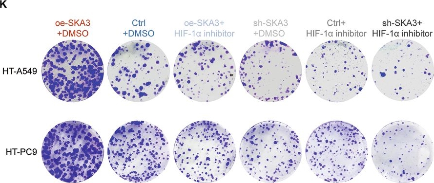 Fig.7.K showing Immunohistochemistry from the publication: SKA3-mediated hypoxia tolerance and metabolic reprogramming promote liver metastasis in lung adenocarcinoma.