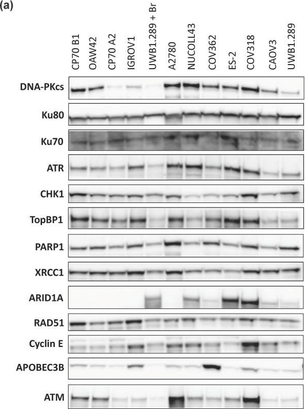 Fig.2.A showing Western Blotting from the publication: The Role of ATR Inhibitors in Ovarian Cancer: Investigating Predictive Biomarkers of Response.